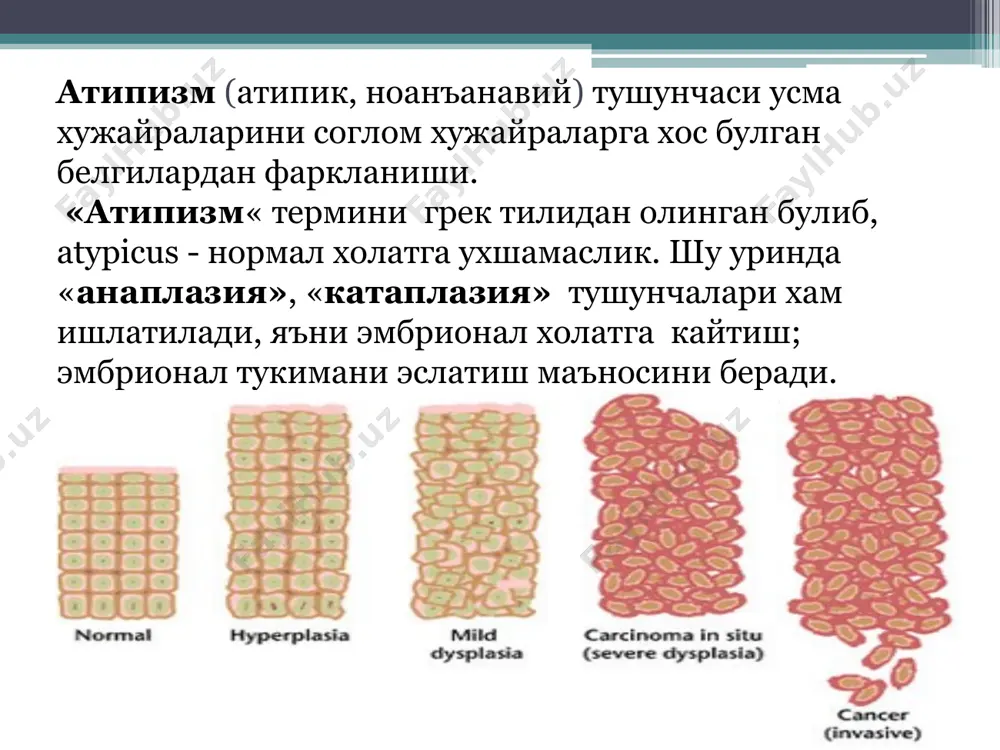ген вируслар мавжуд, паразитлар, замбуруглар, организмада модда алмашинуви бузилиши натижасида пайдо буладиган метаболитлар, эркин радикаллар, апоптоз механизмларини бузилиши ва хаказо. 4. ирсият билан боглик омиллар –рак чакирадиган омил сифатида 5 -15%ни ташкил килади. хужайра геномида буладиган узгаришлар: генетик ностабиллик, хромосома аберрациялари, протоонкогенларда буладиган мутация, онкогенлар фаолаши ва хаказо. барча омиллар эндоген ва экзогенга булинади. саратон келиб чикишида бу омиллар бир - бири билан чамбарчас богликдир. рак олди холат - предрак рак олди холат – асосий популяцияга нисбатан хавфли усма касаллика утиш эхтимоли купрок булган холатдир (фон касалликлар). факультатив рак олди холат – хавфли усмага утиш имконияти паст булган касалликлар. облигат рак олди холат - хавфли усмага утиш имконияти жуда хам юкори булган касалликлар, баъзи холатларда деярли - 100 % гача. саратонга утиш жараёни куйидаги этапларда амалга ошади: факультатив рак олди холат. облигат рак олди холат. преинвазив рак (cancer in situ) – рак хужайралари базал мембранадан чикмаган. эрта инвазив рак. предрак: …