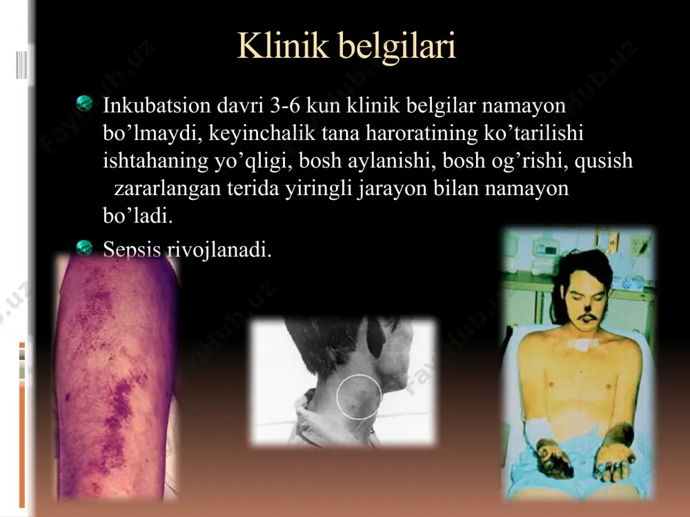 yuqumli va yuqumsiz kasalliklar - Page 2