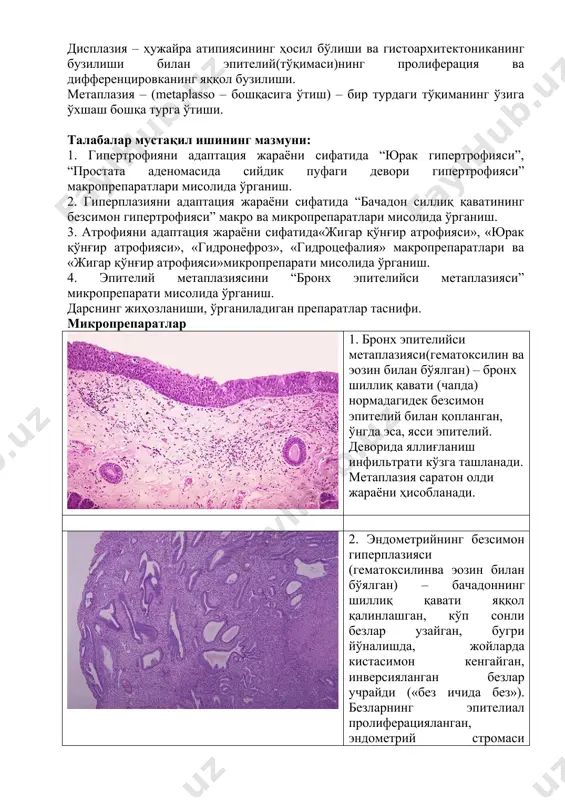 ida). chap qorincha miokardichandiq atrofida gipertrofiyalangan. 6. jigar qo'ng'ir atrofiyasi. organ massasi kamaygan, kapsulasi bujmaygan, parenximaning fibroz to'qima bilan o'rin almashishi oqibatida old tomoni o'tkirlashgan, pardasimon ingichkalashgan (“terisimon qirra”). jigar to'qimasi gepatotsitlarda lipofustsin pigmenti to'planishi natijasida qo'ng'ir rangda. 7. yurakning qo'ng'ir atrofiyasi. yurak hajmi va vazni kichraygan, konsistentsiyasibo'shashgan, epikard bujmaygan. miokard to'qimasi qo'ng'ir rangli, lipofustsin pigmenti to'plangani bilan bog'liq. 9. gidronefroz. buyrak keskin kattalashgan, po'stloq va miya qatlami yupqalashgan va farqlanmaydi, jomi va kosachalar kengaygan.jom bo'shlig'ida korallsimo toshlar uchraydi. gidronefrozbosim atrofiyasiga misol bo'la oladi. 10. gidrotsefaliya (ichki). bosh miya yon qorinchalari kengaygan, shaffof likvor bilan to'lgan. miya to'qimasiatrofiyalangan, ingichkalashgan, kulrang va oq moddalarqiyin differentsiyalanadi. elektronogrammalar 1. kompensatsiya bosqichida miokarda gipertrofiyasi. mitoxondriy (1), miofibrillalarning ko'pligi va kattaligi ko'zga tashlanadi, gigant mitoxondriyalar; ko'p mitoxondriyalar saqlangan. 2. dekompensatsiya bosqichidagimiokardgipertrofiyasi. asosan, mitoxondriyalarda joylashgan destruktiv o'zgarishlar ko'zga tashlanadi: ular vakuolizatsiyalashgan, kristalarparchalangan yoki mitoxondriy tanalari parchalangan (1). tsitoplazmada yog'li kiritmalar paydo bo'ladi. ko'zga tashlangan o'zgarishlar kattalashgan …
