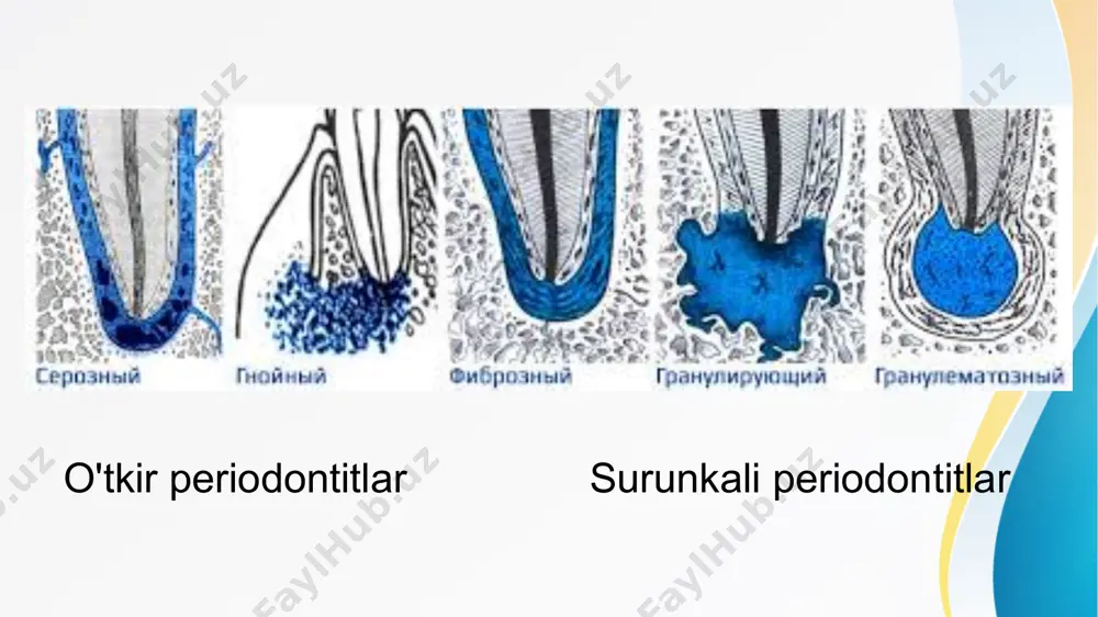 periodont (periodontium) - Page 5