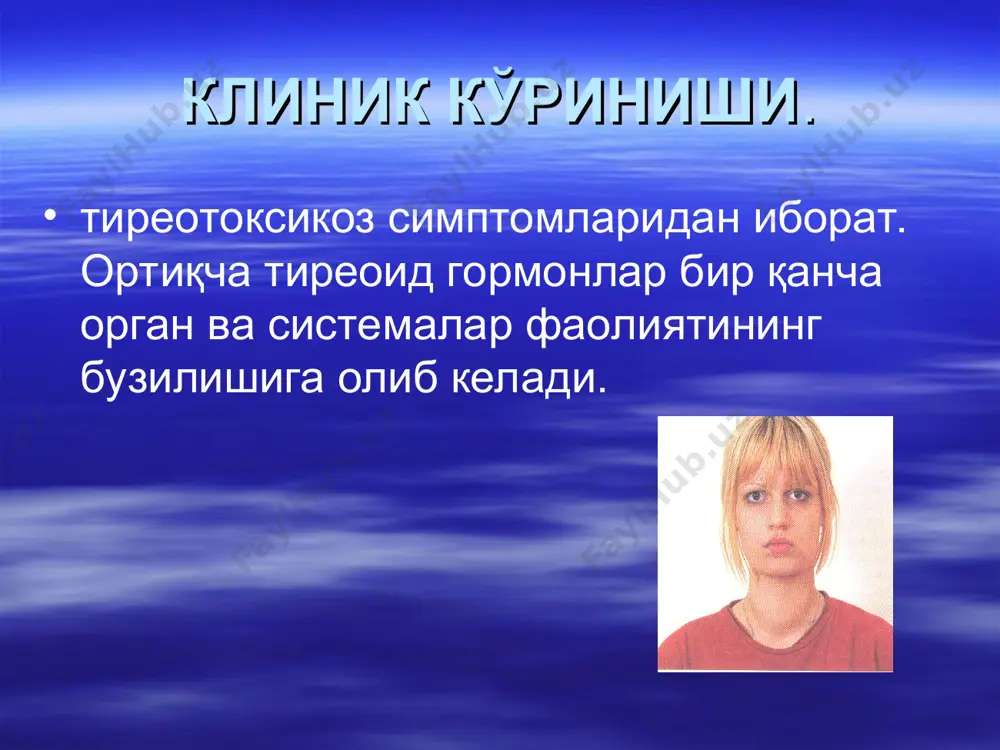 диффуз токсик буқоқ - Page 5