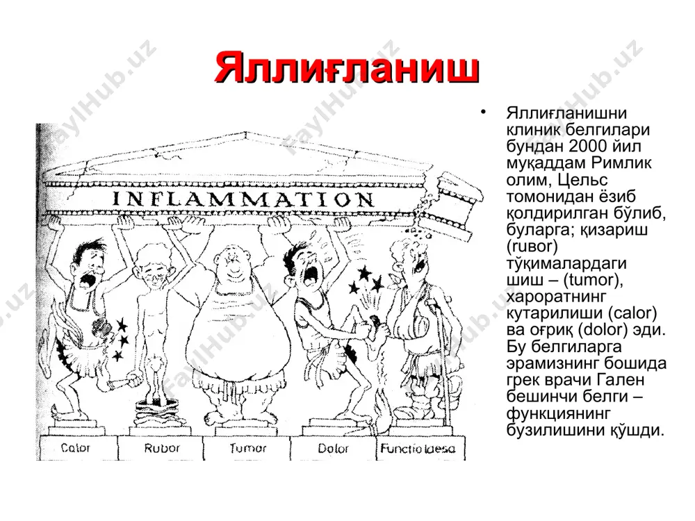 ган плазма медиаторлари системаси, уларнинг боғлиқлиги ва эффекти яллиғланишни таснифланиши яллиғланишни таснифлашда жараённинг характери, морфологик шакли, экссудатив ёки пролифератив фазаси инобатга олинади. кечиши буйича яллиғланиш ўткир, ўткир ости, сурункали бўлади. шуни алохида қайд килиш лозимки, ўткир ости яллиғланишни фарклаш шартлидир. сурункали яллиғланиш бу-репаратив фазанинг кузатилмаслиги. шунинг учун сурункали яллиғланиш дисрегенерациянинг асосий кўриниши хисобланади. яллиғланиш фазасининг устунлигига кўра экссудатив ва пролифератив яллиғланишлар фарқланади. уларнинг хар бири бир неча турга бўлинади. экссудатив яллиғланиш яллиғланишнинг бу турида иккинчи фаза, яъни экссудация устунлик қилади. бу фаза хужайра ва тўқималар шикастланганидан сўнг турли вақтда яллиғланиш медиаторлари ажралиши билан вужудга келади. капиллярлар ва веналар деворларининг жарохатланиши даражаси ва медиаторлар таъсирининг интенсивлигига кўра экссудатнинг характери турлича бўлади. экссудатив яллиғланиш енгил шикастланишларда яллиғланиш ўчоғида факат кичик молекуляр альбуминлар, оғир шикастланишларда экссудатда йирик молекулали глобулинлар ва нихоят фибиногеннинг жуда йирик молекулалари пайдо бўлади ва фибриноген тўқимада фибринга айланади. экссудат таркибига, шунингдек қон хужайралари, шикастланган тўқиманинг хужайравий элементлари ва бошқалар …