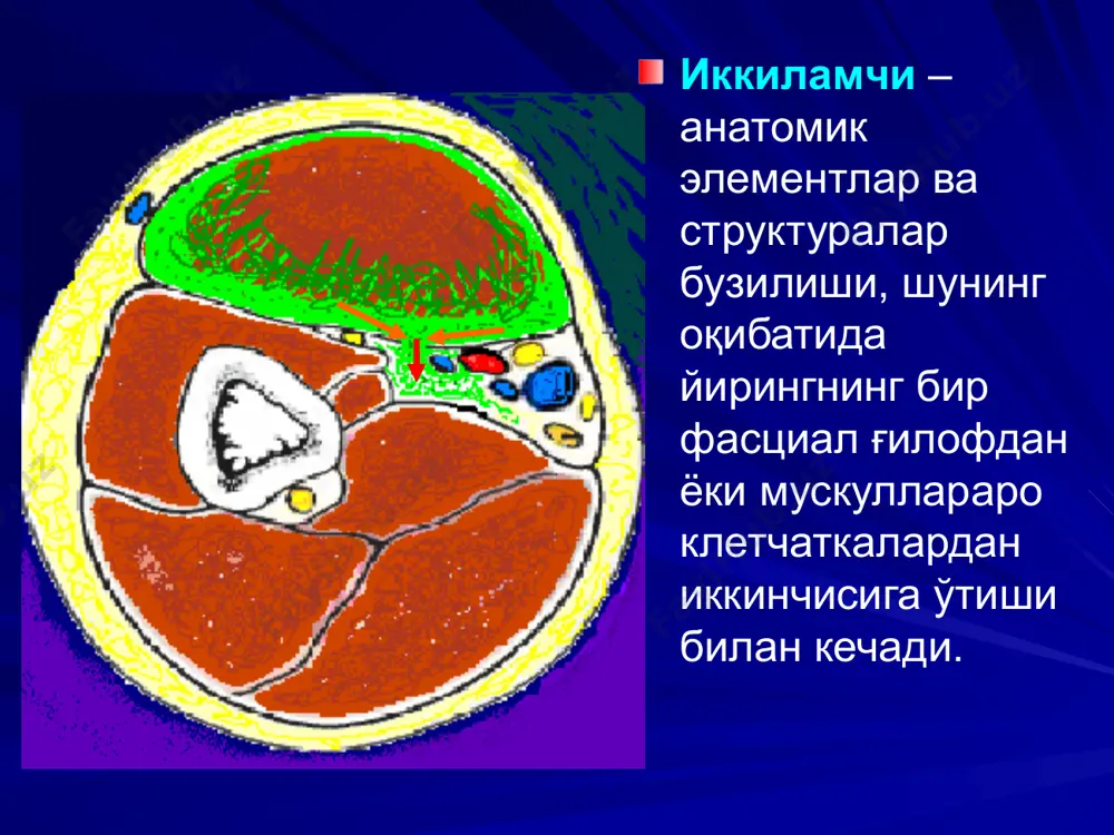 плекс шикастланиши кузатилади. параангиал қин ичидаги ғовак клетчатка йирингнинг қин бўйлаб тезда тарқалишига олиб келади, бунга артерияларнинг пулсацияси ҳам қўшимча шароит яратади. fasciae endocervicalis, endothoracica, endoabdominalis, endopelvina. бу фасциялар йирингли жараённинг кенг тарқалишига, ва у соҳадан бошқа соҳага ёки бўшлиққа тезлик билан ўтишига сабабчи бўлади. бирламчи целомик фасцияларнинг яллиғланиш жараёни тарқалишидаги аҳамияти бўйиннинг превисцерал флегмоналари олдинги кўкс оралиғи клетчаткасига; ретровисцерал флегмоналарда орқа кўкс оралиғига; орқа медиастинитда йиринг тарқалиши кўкрак ичи фасцияси бўйлаб ёки плевра йўналишига мос ҳолда параплеврал клетчаткага; параплеврал клетчаткадан диафрагмадаги тирқишлар орқали қорин парда орти бўшлиғи клетчаткасига; қорин ичи фасцияси бўйлаб қорин парда орти бўшлиғидан тос бўшлиғи клетчаткасига тарқалиши мумкин. тана бўшлиқларида юзага келган йирингли жараён фасция варақалари, тоирм-нерв тутамлари йўналиши, мускуллараро клетчакалар бўйлаб тананинг юза соҳаларига ҳам тарқалади. бундай ҳолатлар юзага келишида анатомик тешиклар роли катта. пти учбурчаги (қорин парда орти флегмоналари). йирингли жараёнлар тарқалишининг иккиламчи йўллари «қайси жой ингичка бўлса, ўша жой йиртилади» тамойилига биноан фасциал …