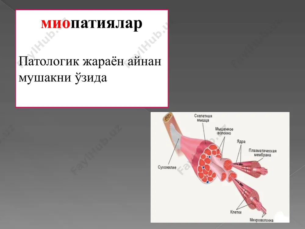 b namoyon bo'ladi • psevdogipertrofiyadan tashqari barcha yuqoridagi miopatiyalar simptomakompleksi kuzatiladi bekker miopatiyasi • asosan kattalarda kuzatiladi • autosom - retsessiv va x-xromosomaga birikkan tipda utadi, asosan erkaklarda uchraydi • kasallikning 20-40 yoshlarda boshlanishi • engil kechadi va kech tashxislanishi mumkin barcha miopatiyalarga xos belgilar kuzatiladi elka –kurak- yuz landuzi-dejerin miopatiyasi autosom-dominant tipda nasldan-naslga o'tadi 15-25 yoshlarda rivojlanadi • juda sekin avj oladi • atrofiyalar asosan mimik va elka mushaklarida kuzatiladi • elka mushaklari atrofiyasi - «qush qanoti» va «erkin elkalar» simptomi kuzatiladi bolalar spinal amiotrofiyasi verdnig goffman kasalligi • autosom-retsessiv tipda naslga uzatilishi. • orqa miyaning oldingi shoxi xujayralari va oldingi ildizchalarida degeneratsiya tufayli keb chiqadi • prenatal anamnezida: darrov yig'lamaydi, emishi, harakati juda sust bo'ladi • «shalpaygan bola» sindromi – periferik tetraparez, tetraatrofiya, arefleksiya, fastsikulyatsiyalar( mayda tortishishlar), bulbar buzilishlar kuzatiladi • jismoniy rivojlanish templarida orqada qoladi: boshini tuta olmaydi, o'girilmaydi, o'tirmaydi • yaxshi parvarishdagina 2 yoshgacha yashashi mumkin …
