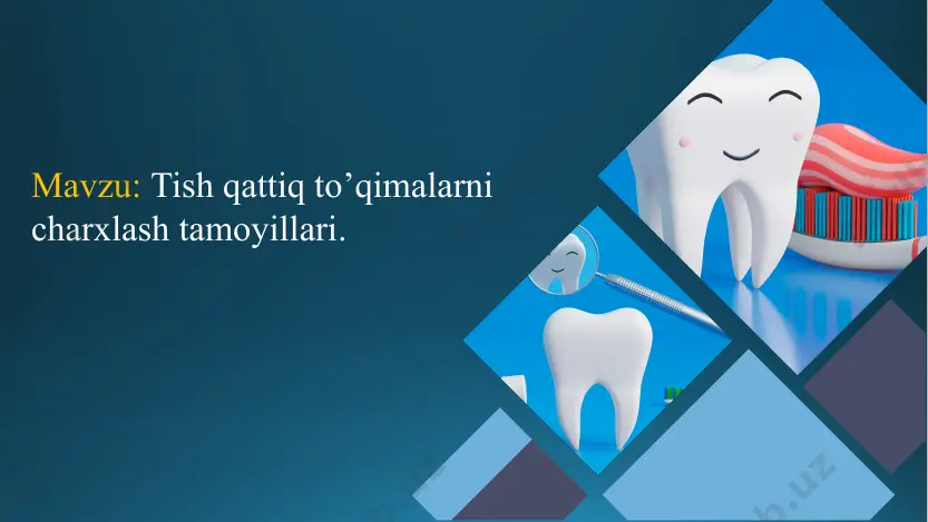 alshunoslik sohasidagi yutuqlar tishlarni charxlash uchun innovatsion materiallarni ishlab chiqishga olib keldi, tish restavratsiyasining chidamliligi va uzoq umrini oshiradi. klinik mulohazalar klinik amaliyotda stomatologlar davolashning optimal natijalarini ta'minlash uchun tishni keskinlashtirish tamoyillarini qo'llashda bemorga xos omillar va klinik sharoitlarni hisobga olishlari kerak. kelajakdagi yo'nalishlar tishning qattiq to'qimalarini charxlashning kelajagi texnologiya, materiallar va texnikalardagi yutuqlarni o'z ichiga oladi, bu esa tishlarni o'tkirlash jarayonlarining aniqligi va samaradorligini yanada oshirishga qaratilgan. kelajakda tish salomatligiga ta'sir etuvchi omillar • eksenel qisqarishning yetarli emasligi haddan tashqari konturli tiklash periodontal kasallik okklyuzionning kamayishi yomon shakl - okluzal disfunktsiya chegara joyini noto'g'ri tanlash •emal yoki tojning sinishi chiplari asosiy xulosalar tish qattiq to'qimalarining asosiy tamoyillari charxlash tish tarkibini tushunish, aniq asboblardan foydalanish, biomexanik jihatlarni hisobga olish va ilg'or materiallarni qo'llashni o'z ichiga oladi. xulosa qilib aytadigan bo'lsak, tishning qattiq to'qimalarini charxlash tamoyillarini o'zlashtirish yuqori sifatli stomatologik yordam ko'rsatish va bemorlarning uzoq muddatli og'iz salomatligini ta'minlash uchun juda …
