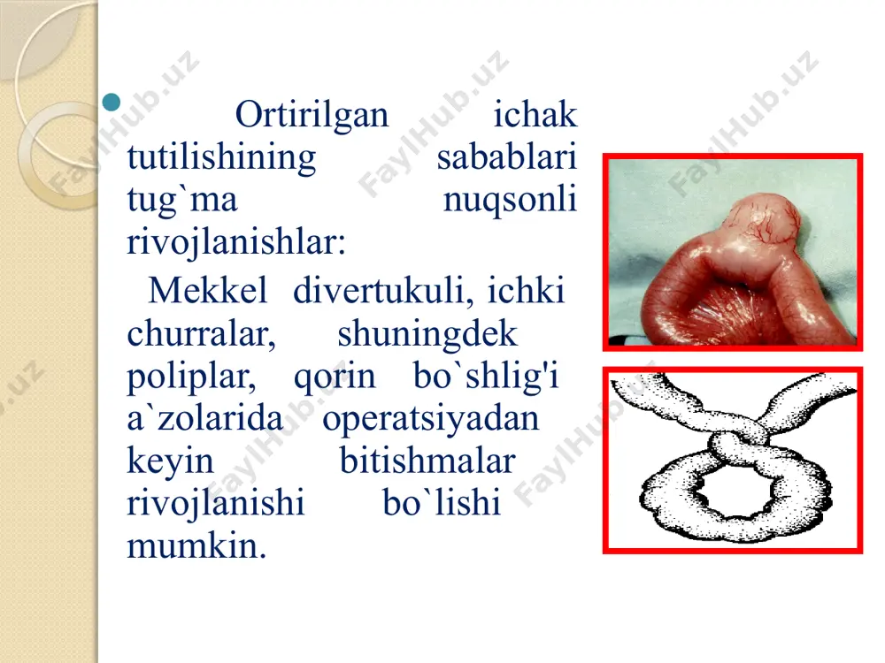 mor kech kelsa, peritonit rivojlangan bo`lsa, invaginat paypaslanmaydi. barmoq bilan albatta, to`g`ri ichakni tekshirish kerak. bunda perchatkada shilliq aralash qon ko`rinadi. diagnostikasi dastlab qon analizida o`zgarish bo`lmaydi, yoki kam hollarda liycotsitoz kuzatiladi. qo`shimcha tekshirishlardan utt, qorin sohasining obzor rengenografiyasi (vertikal holatda), kontrastt yoki bariyli irrigografiya o`tkaziladi. invaginatsiyada utt da ‘’mishen’’ simptomi bo`lishi xos. invaginatning ko`ndalang kesmasida ikkita gipoexogen halqasi, bitta giper exogen halqa bilan bo`linganligi ko`rinadi. qorin sohasining vertikal holatdagi obzor rentgenografiyasida ko`p sonly kloybir kosachalarning bo`lishi xos. pnevmoirrigografiyada invaginatning boshi ikki tomonida havo borligi - (symptom ‘’kleshni’’ , ‘’serp’’, ‘’kakardi’’) ko`rinadi. differential diagnostikasi dezenteriya salmonellyoz mekkel divertikulidan qon ketish to`g`ri ichak tushishi shenveyn-fehox kasalliklari bilan difdiagnoz o`tkazish kerak. davolash invaginatsiya konservativ va operativ usullarda davolanadi. konservativ usuli umumiy og`riqsizlantirish ostida operatsion xonada o`tkaziladi. bunda roshal apparatidan foydalaniladi. dastlab oshqozonda zond qo`yiladi. to`g`ri ichakka obturatorli naycha kiritilib havo jo`natiladi. richerdson balonchasi bilan kichik bolalarga havo bosimi 80 mm. simob ustunida, …